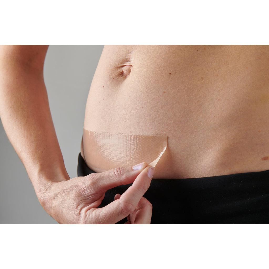 My Scar Active Caesarean Silicone Wound Healing Strips